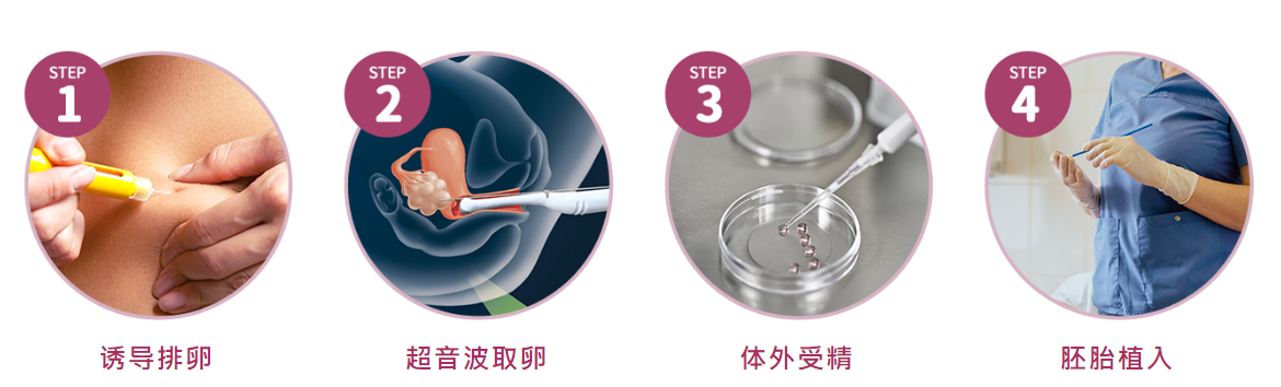 美国试管婴儿过程